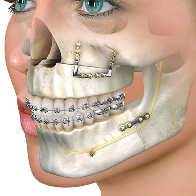 Cirurgia Bucomaxilofacial Chez Clinique